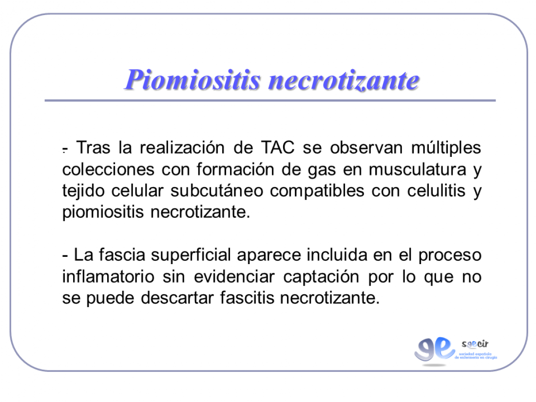 Diapositiva04