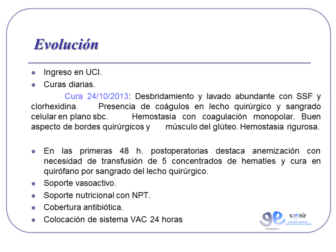 Diapositiva17